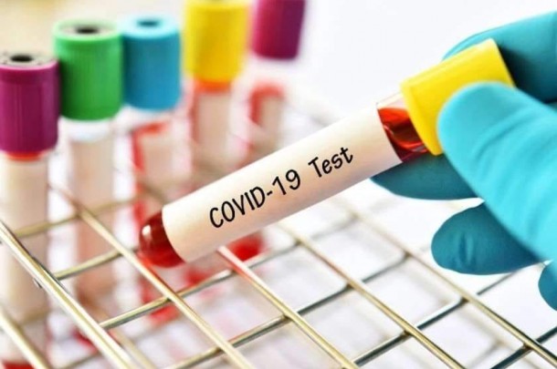 თიანეთის მუნიციპალიტეტის განცხადება COVID 19-ზე ანტიგენის სწრაფი ტესტით მოსახლეობის მასობრივი დიაგნოსტირების შესახებ