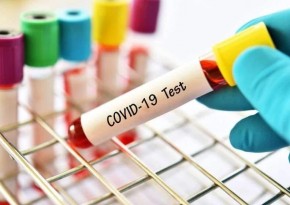 თიანეთის მუნიციპალიტეტის განცხადება COVID 19-ზე ანტიგენის სწრაფი ტესტით მოსახლეობის მასობრივი დიაგნოსტირების შესახებ